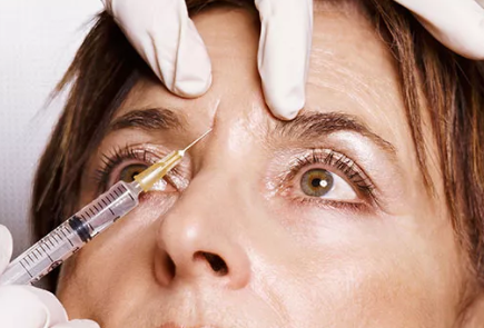 Mature patient receiving a botulinum toxin injection near the eye