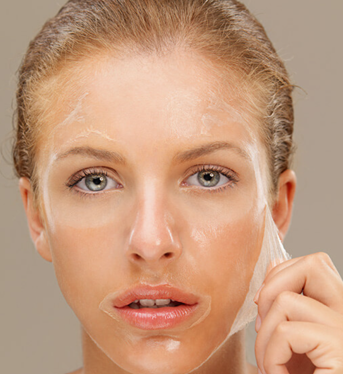 Woman peeling a chemical peel film from her face