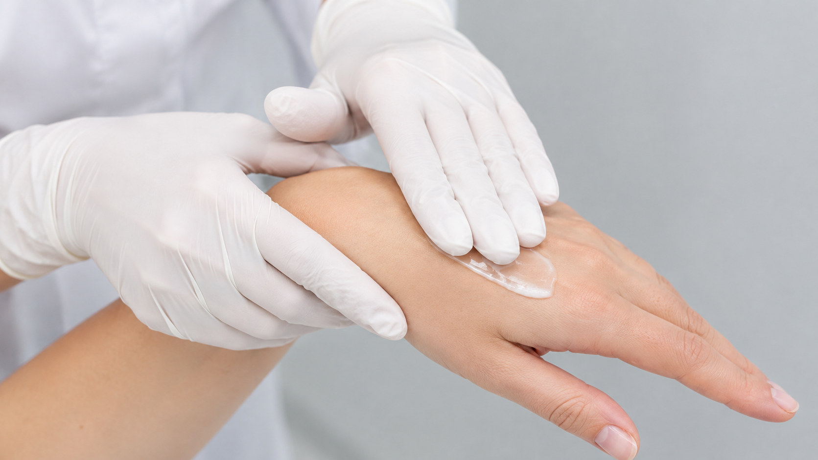 Gloved hands applying a soothing cream to a patient's hand