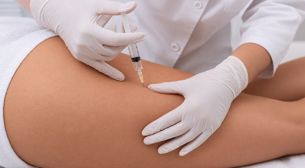 Gloved hands giving a mesotherapy injection on a patient's thigh