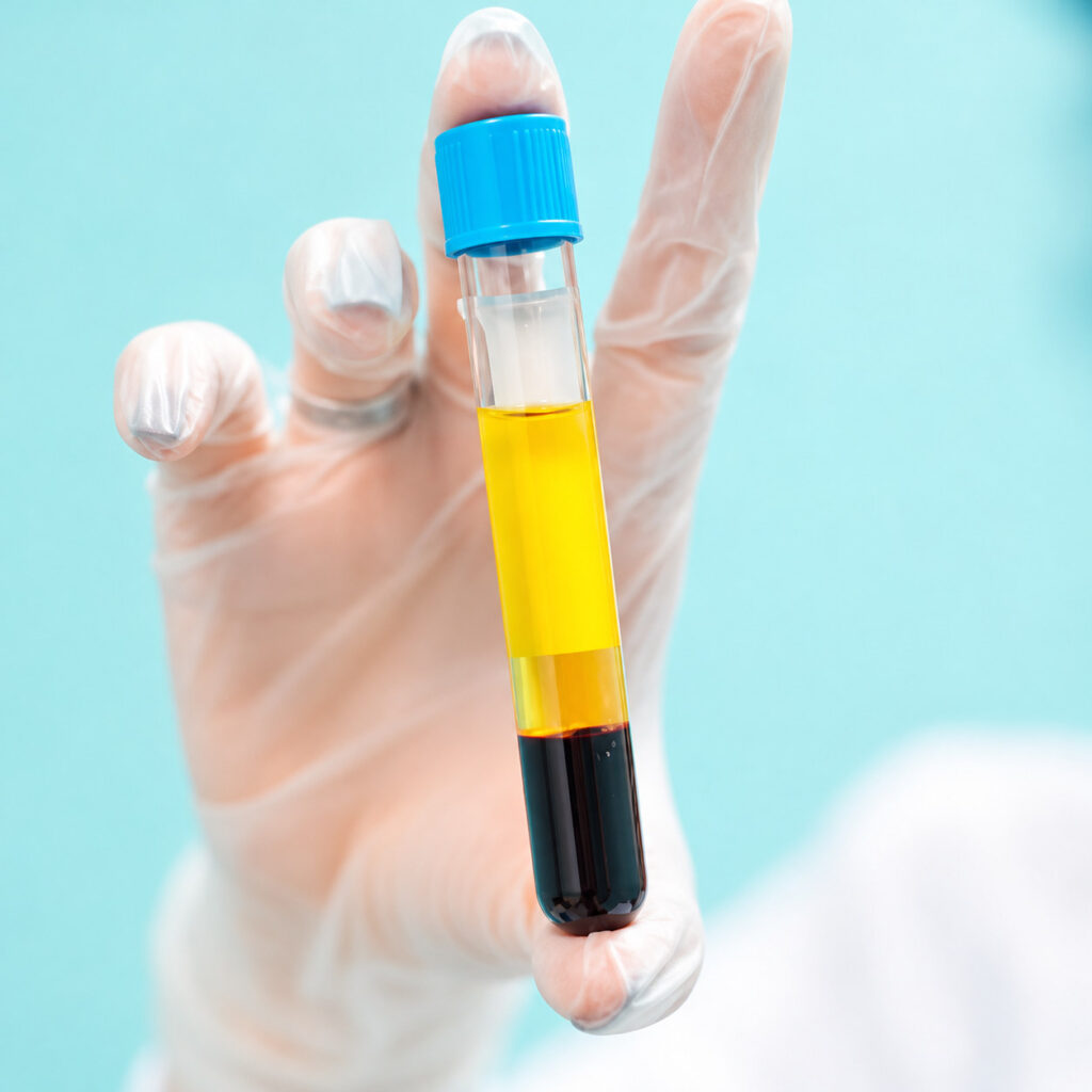 Gloved hand holding a centrifuged blood tube with the plasma separated on top