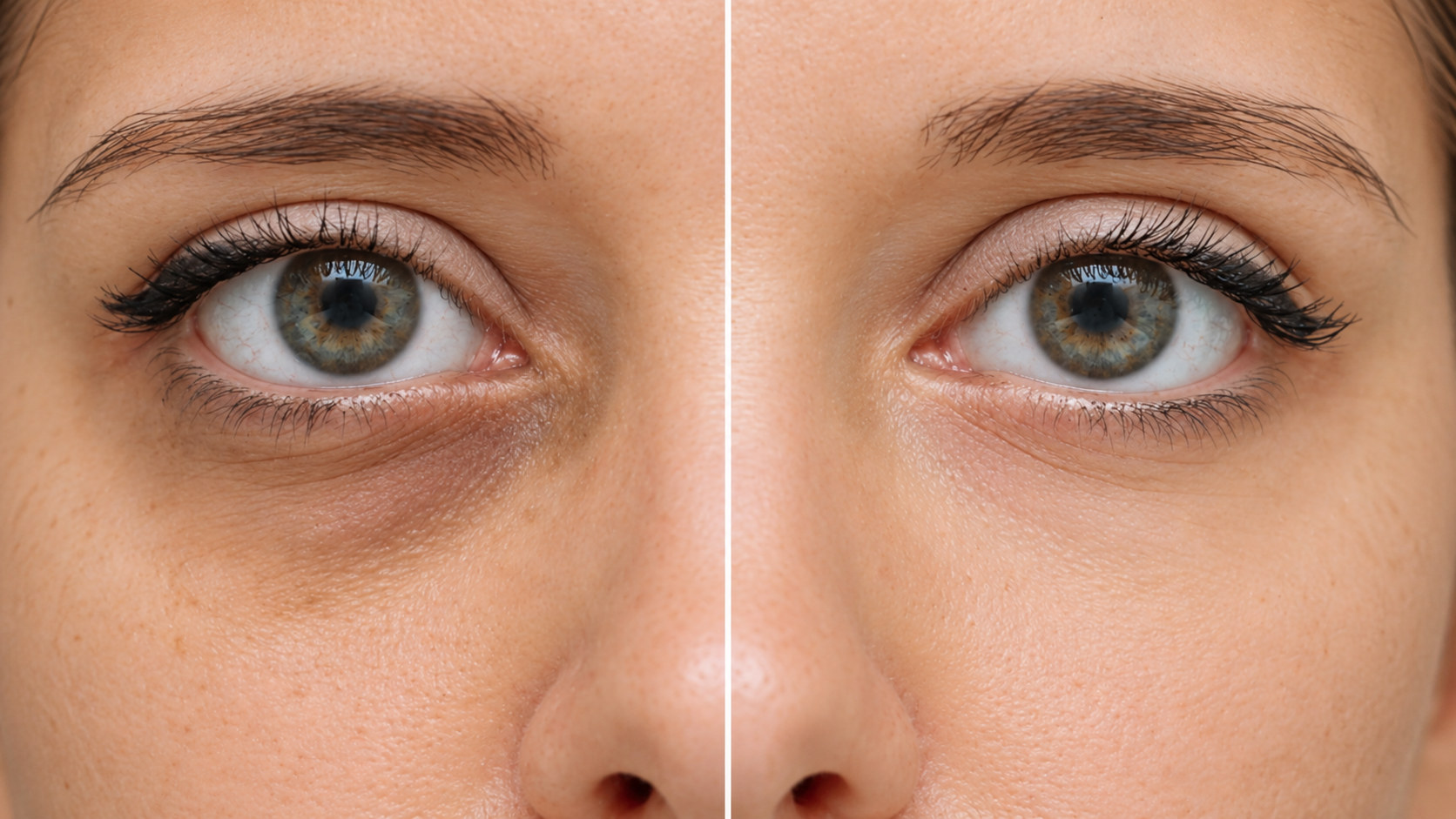 Close-up of a woman's eyes split down the middle to compare the skin around them