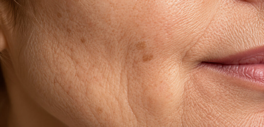 Close-up of the skin around the mouth and cheek showing fine lines